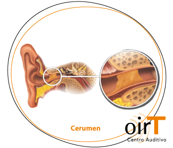 cerumen-en-oido